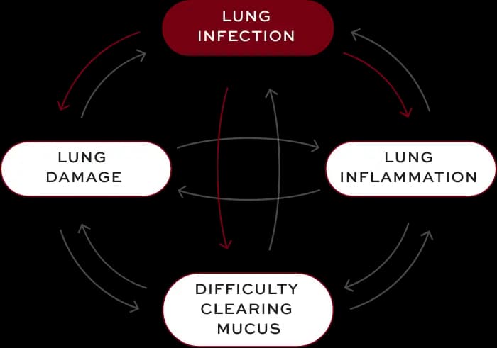 Bronchiectasis (BE) interconnected factors—lung infection